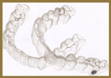 Invisalign in Royal Palm Beach, Palm Beach Gardens and Loxahatchee